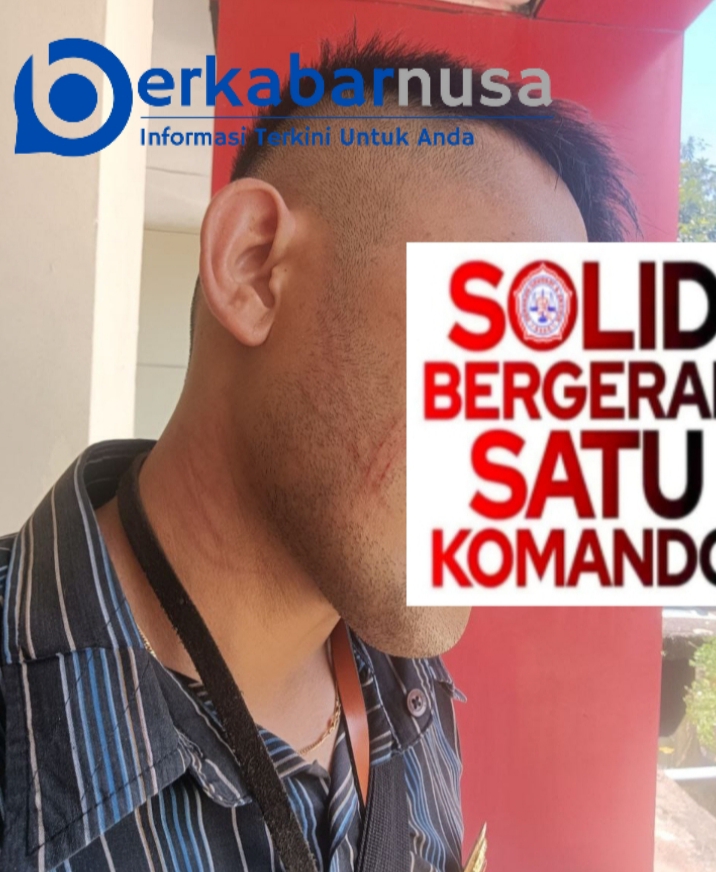 Jurnalis Menjadi Korban Dugaan Pengeroyokan Saat Peliputan.
